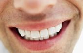 De bijwerkingen van Numbing geneeskunde voor tanden vullingen