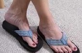 Hoe kom je van donkere vlekken van voeten