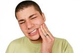 Hoe te genezen van een Abscessed tand