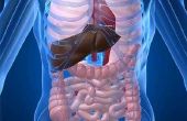 Wat zijn de symptomen van fase vier leverkanker?