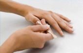 Hoe Trim nagelriemen