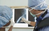 How to Spot problemen op een röntgenfoto