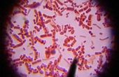 Micro-organismen & ziekte bij de mens