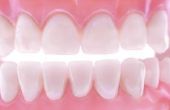 Hoe te repareren van een tand met Cyanoacrylaat lijm