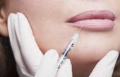 Hoe te behandelen hematoom & zwelling na Botox