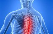 Wat is Spinal decompressie?