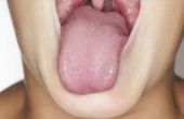 Het gebruik van een tong schraper