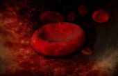 Wat zijn de oorzaken van zeer lage hemoglobine telling?