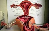 Wat zijn de bijwerkingen van het baarmoederslijmvlies met NovaSure?
