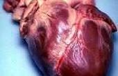 Wat zijn de oorzaken van een vergroot hart?
