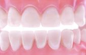 Hoe te verzachten van Plaque op tanden