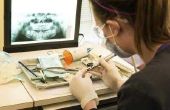 Wat zijn de voors & tegens van wordt een Orthodontist?