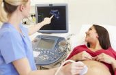Hoe vroeg kan een Baby op een echografie worden gezien?