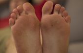 How to Get droge huid van de onderkant van uw voeten