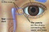 Wat Is de droge ogen syndroom bij kinderen?
