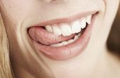 Hoe te verwijderen van tand vlekken met een gum