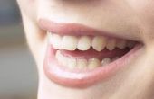 De beste manieren om de Nicotine vlekken verwijderen van tanden