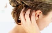 Hoe te behandelen pijnlijke haarfollikels in de hoofdhuid