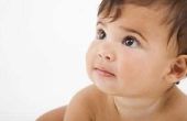 Informatie over Vitiligo bij baby 's