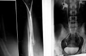 X-Ray medisch technicus salaris