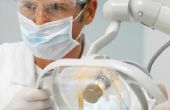 De gemiddelde kosten van tandheelkundige implantaten