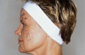 How to Fake een Facelift