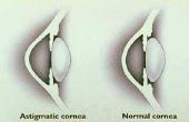Hoe om te testen voor een astigmatisme thuis