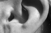 Tekenen & symptomen van kanker van de huid van het oor