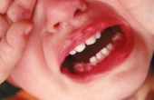 Hoe te weten als een Baby is tandjes