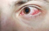 Over de teller Eye geneeskunde om te voorkomen dat oog drenken
