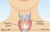 Multinodular schildklier symptomen