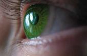 Tekenen & symptomen van parasieten in de ogen