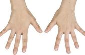 Tekenen en symptomen van slechte circulatie aan handen en voeten