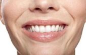 Tandheelkundige gevaren van hoge PSI Water reiniging van de tanden