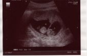 Wat te verwachten van de twaalf weken zwanger van een tweeling