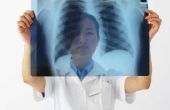 Hoe te ontgiften van je longen