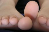Hoe te voorkomen dat de infectie in een besnoeiing van de voet